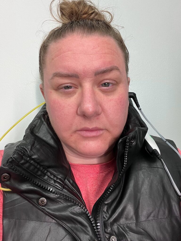 The Day I Lost 40% of My Hearing